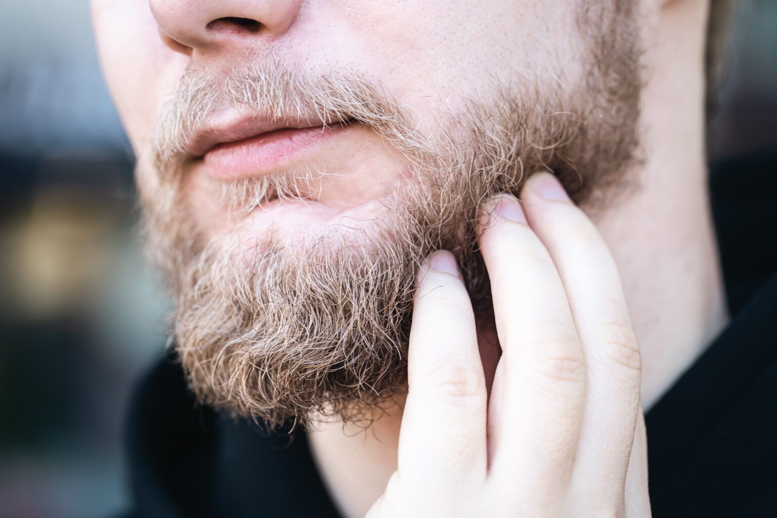 Por Qu Se Producen Los Huecos En La Barba Y C Mo Solucionarlos